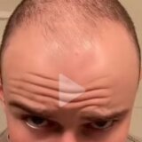 Ruzmarinova voda je hit na TikToku, kažu da je spas od ćelavosti: Ovo je recept, pravi se lako 2