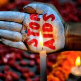 Afrika i virusi: Pet afričkih zemalja na putu da iskorene HIV do 2030. godine, kažu iz UN 5