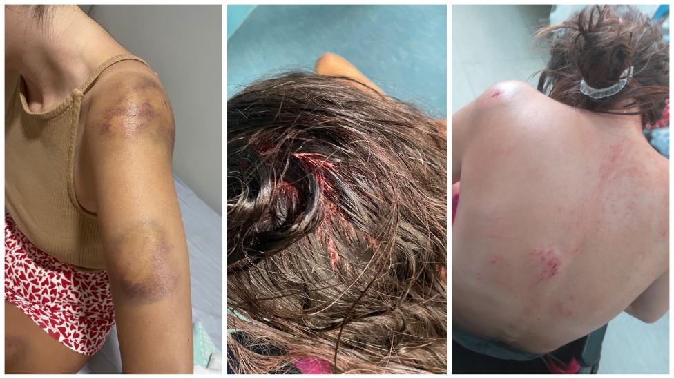 Superćelijska oluja: Kolika je šteta od nevremena u Srbiji i ko će da je plati 6 Posledice oluje