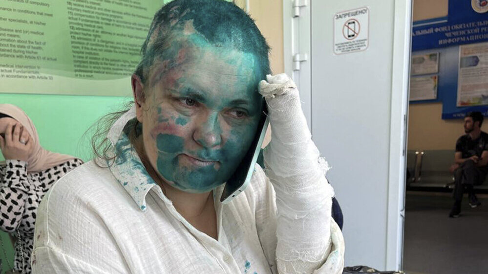 Nagrađivana, zastrašivana i prebijana: Ko je Elena Milašina, ruska novinarka koju su u Čečeniji pretukli i slomili joj prste? 1