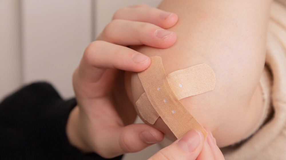 Često vam se pojavljuju modrice po koži: Ovo su mogući uzroci 1