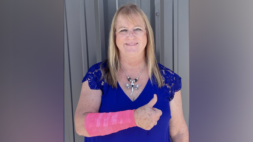 Amerika i životinje: Soko ispustio zmiju na Teksašanku, pa je napali oboje 1 The victim with a cast on her arm