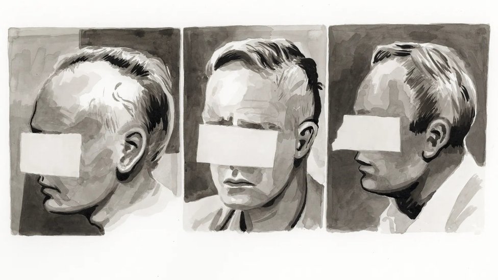 Ponovni rast kose Aleksa Grejvsa, nacrtan na osnovu anonimne arhivske fotografije načinjene mesec dana, dva meseca i četiri meseca posle nesreće