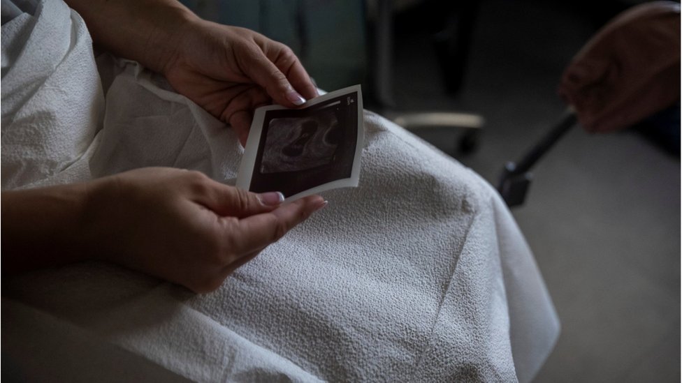 Srbija i reproduktivno zdravlje: Rak ne mora da bude prepreka za roditeljstvo 4 Žena gleda sliku sa ultrazvuka