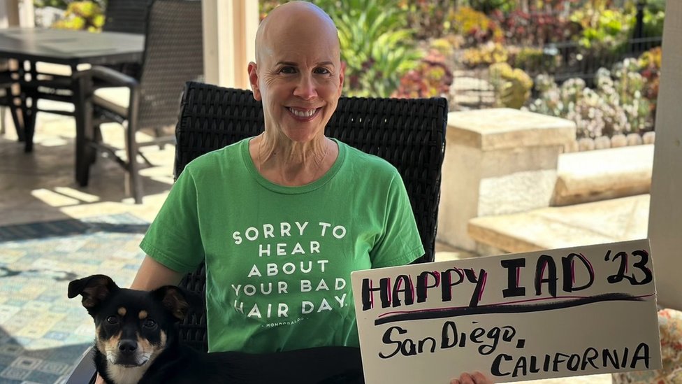 Zdravlje: „Mnogo više dobijete nego što izgubite", priče ljudi koji žive sa alopecijom 3 Meri Maršel