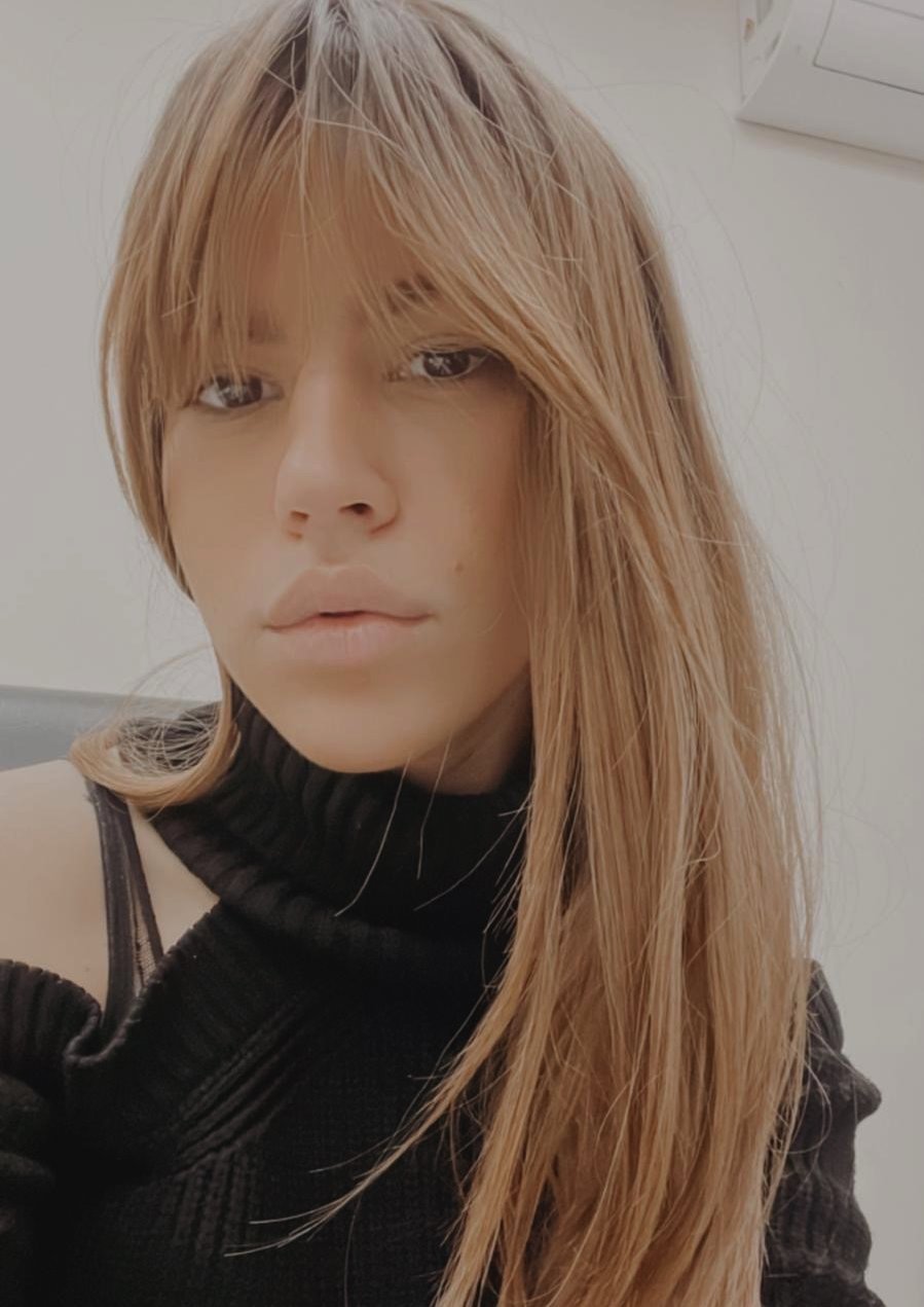 Zdravlje: „Mnogo više dobijete nego što izgubite", priče ljudi koji žive sa alopecijom 4 Sonja Milosavljević