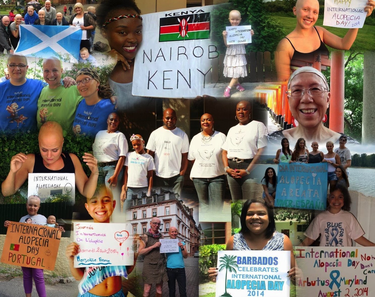 Zdravlje: „Mnogo više dobijete nego što izgubite", priče ljudi koji žive sa alopecijom 7 Alopecija