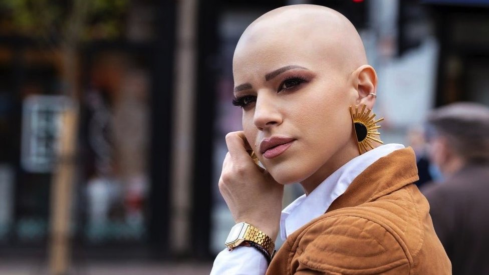 Zdravlje: „Mnogo više dobijete nego što izgubite", priče ljudi koji žive sa alopecijom 8 Sonja Milosavljević