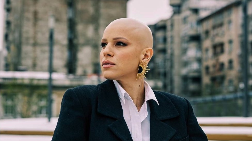 Zdravlje: „Mnogo više dobijete nego što izgubite", priče ljudi koji žive sa alopecijom 1 Sonja Milosavljević