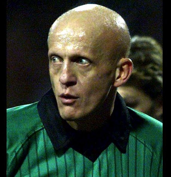 Zdravlje: „Mnogo više dobijete nego što izgubite", priče ljudi koji žive sa alopecijom 5 Pjerluiđi Kolina