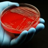 Zdravlje: Da li se antibioticima uništavaju i neophodne bakterije u ljudskim crevima 15