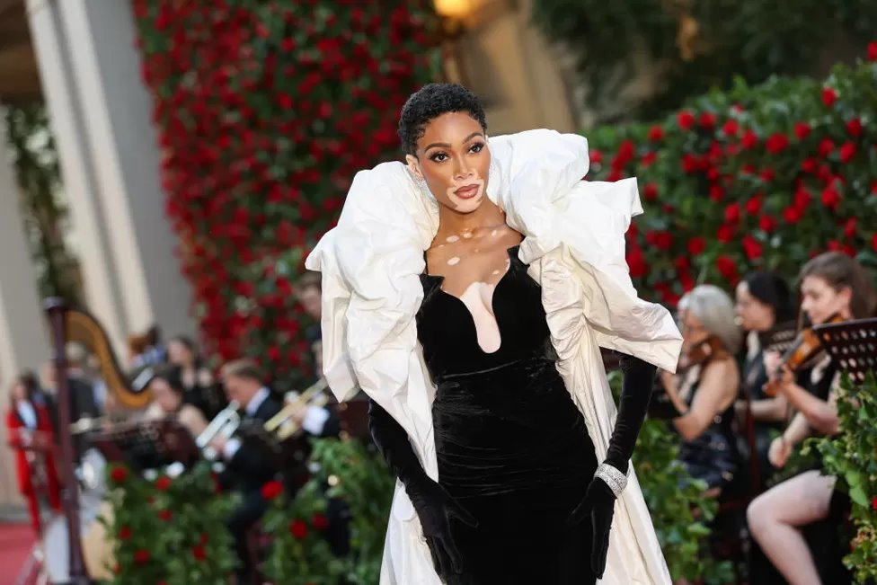 Moda u Londonu: Zvezde na crvenom tepihu, Sijena Miler pokazala trudnički stomak 9 Kanadska manekenka Vini Harlou