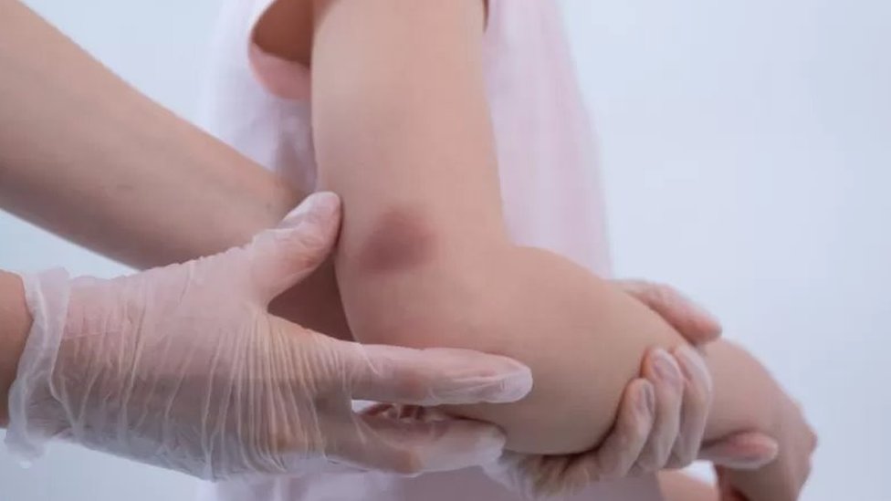 Rusija i Ukrajina: „Za tri meseca videla sam dete jednom" - zašto se Ukrajincima oduzimaju deca u zapadnoj Evropi 4 modrice