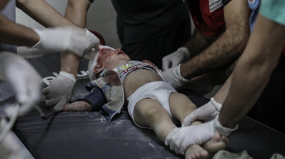 "Malo svetla, nema kreveta, nedovoljno anestezije, primorani da biraju kojim pacijentima dati prioritet": Svedočenje lekara iz bolnice u Gazi 1