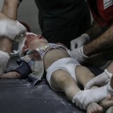 "Malo svetla, nema kreveta, nedovoljno anestezije, primorani da biraju kojim pacijentima dati prioritet": Svedočenje lekara iz bolnice u Gazi 8