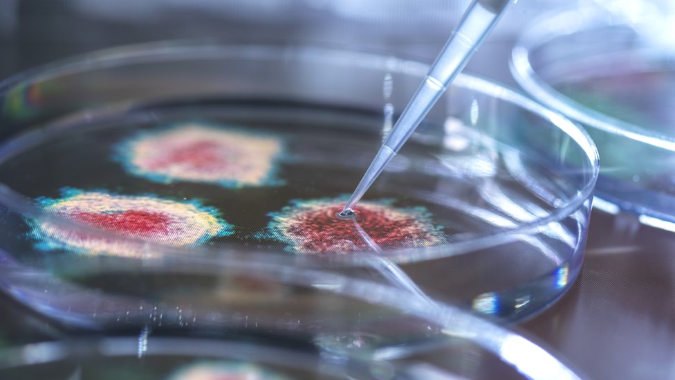 Medicina i teorije zavere: Ljudi koji ne veruju u bacile, „vaše zdravlje je u vašim rukama" 1 Virusi, bacili