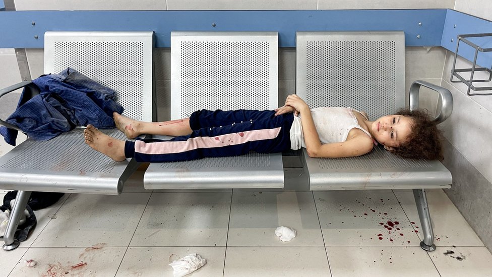 Izrael i Palestinci: Napadi na Gazu se nastavljaju, bolnice prepune - uhapšeno stotine ljudi povezanih sa Hamasom, kažu izraelske snage 2 Povređeno dete u bolnici u Gazi