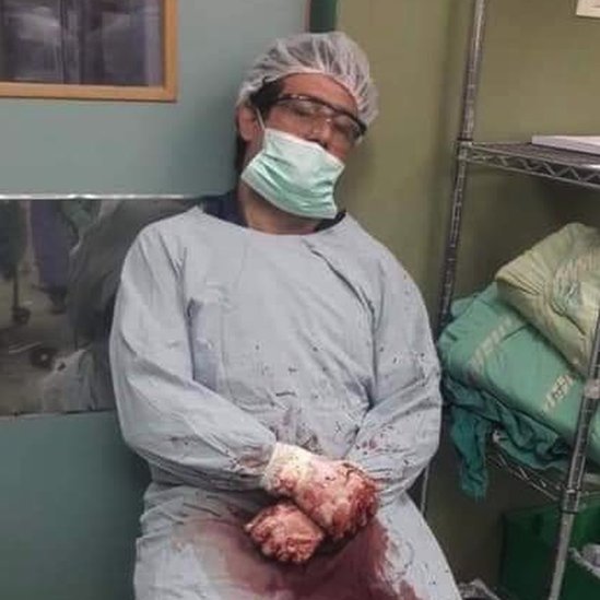 Izrael i Palestinci: Porodice razorene eksplozijom u bolnici u Gazi - „Verovali smo da je to najbezbednije mesto za decu" 5 Dr Adnan Al Bursh wearing a blood-stained theatre gown