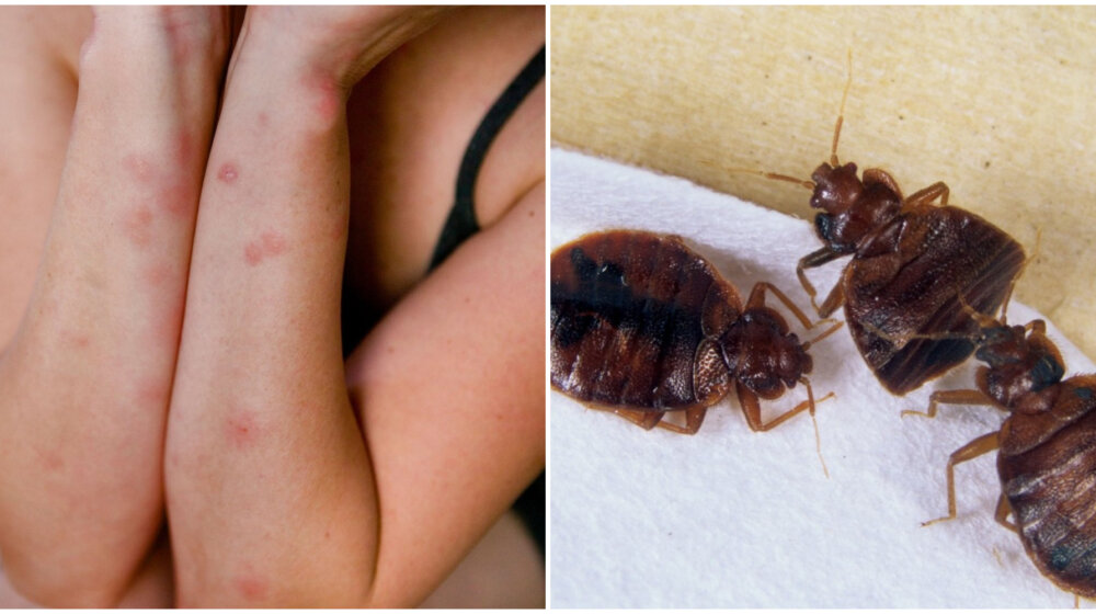 Kako da znate da vam se stenice nalaze u domu: Na ove načine možete da ih se rešite 1