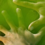 Srčani problemi mogu se prepoznati po prstima 2