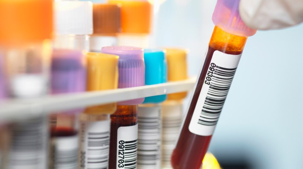 Da li krv stogodišnjaka krije tajnu dugovečnosti: Ovo su otkrili naučnici 1