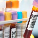 Da li krv stogodišnjaka krije tajnu dugovečnosti: Ovo su otkrili naučnici 1