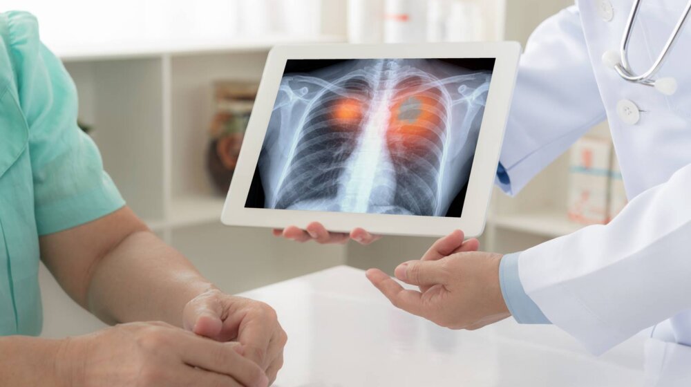 Pet manje poznatih simptoma raka pluća 1