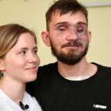 Rusija i Ukrajina: Rat stvorio armiju amputiranih, pravu pokretnu traku slomljenih tela 2