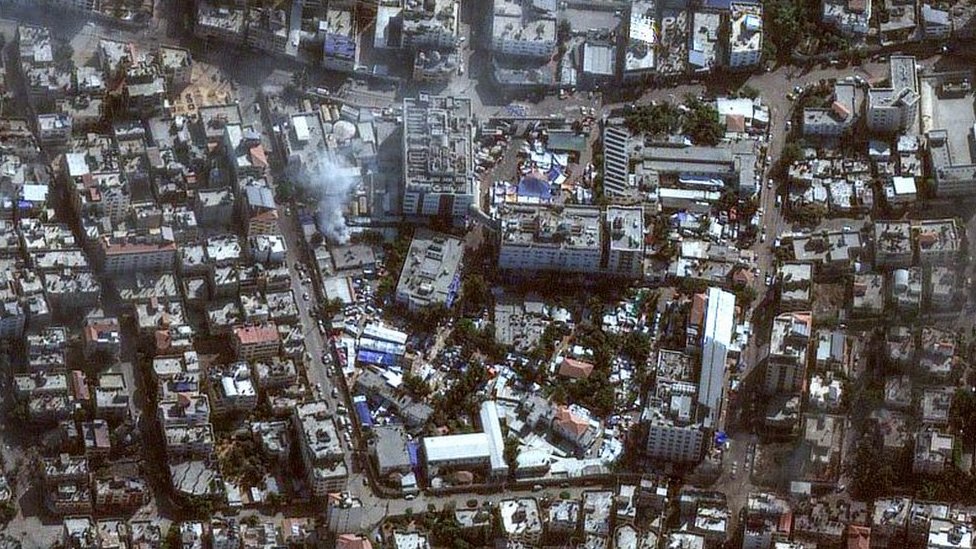 Izrael i Palestinci: Izraelska vojska ispituje ljude unutar glavne bolnice u Gazi, kažu svedoci 5 Bolnica Al-Šifa i naselje oko nje