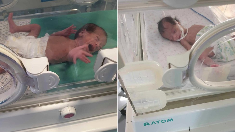 Prevremeno rođene bebe iz Gaze ponovo sa roditeljima: „Čudo je da su još žive“ 2 Prevremeno rođene devojčice Leen (levo) i Lajan (desno)