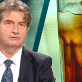 Simptomi ateroskleroze: Bolest koja dovodi do infarkta, otkriva dr Radak 2