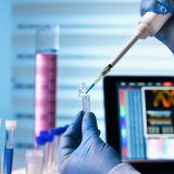 Brzi test pozitivan na drogu, krvni negativan: Slučaj advokata Aleksića otvorio pitanje pouzdanosti testova 4