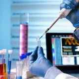 Brzi test pozitivan na drogu, krvni negativan: Slučaj advokata Aleksića otvorio pitanje pouzdanosti testova 2