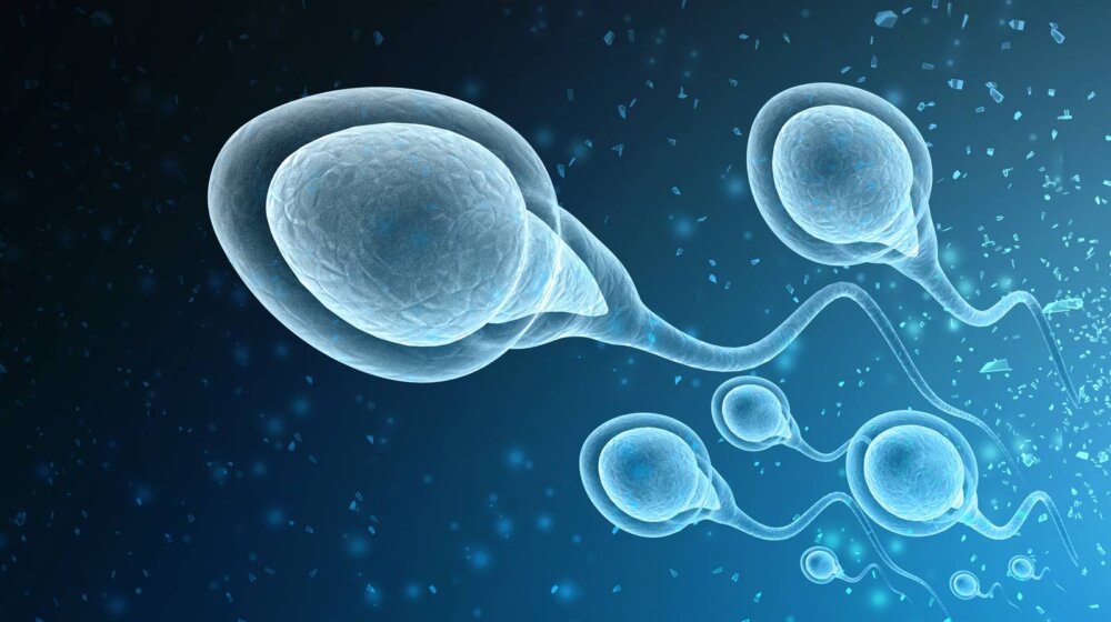 manjak spermatozoida