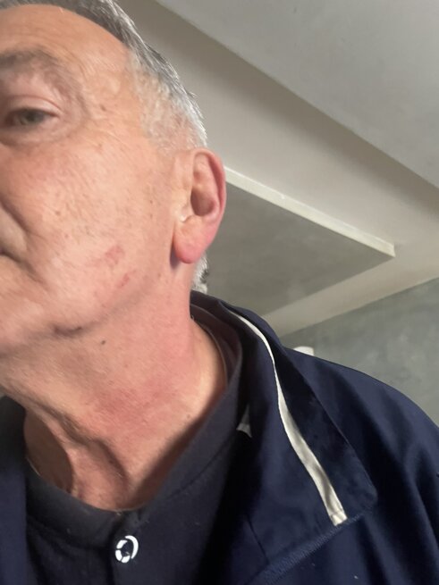 Da li je Novica Tončev uhvatio za gušu poverenika POKS-a: Šta se zaista dogodilo na proslavi Zdravstvenog centra u Surdulici? 2