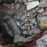 Krvava dijareja, žutica, hepatitis: CNN o hiljadama Palestinaca obolelim u ratom razorenoj Gazi 6