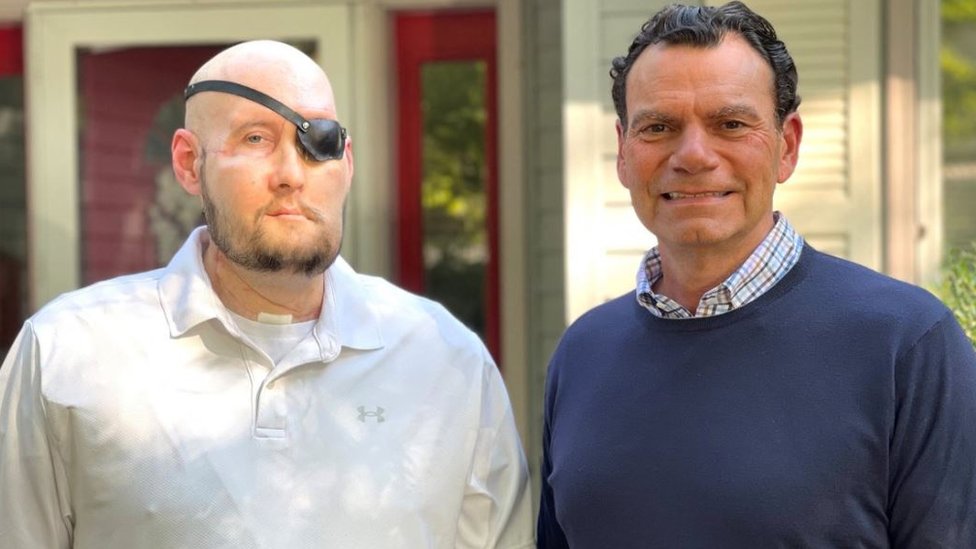 Aron Džejms, iz Arkanzasa, zajedno sa doktorom Edvardom D. Rodrigezom pošto je prošao kroz prvu transplantaciju celog oka u svetu