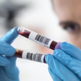 Medicina: Novi test krvi može da pokaže koliko brzo nam stare unutrašnji organi, kažu naučnici 8