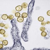 Zdravlje: Česte pojave neobjašnjivih zaraznih bolesti nisu neuobičajene 1