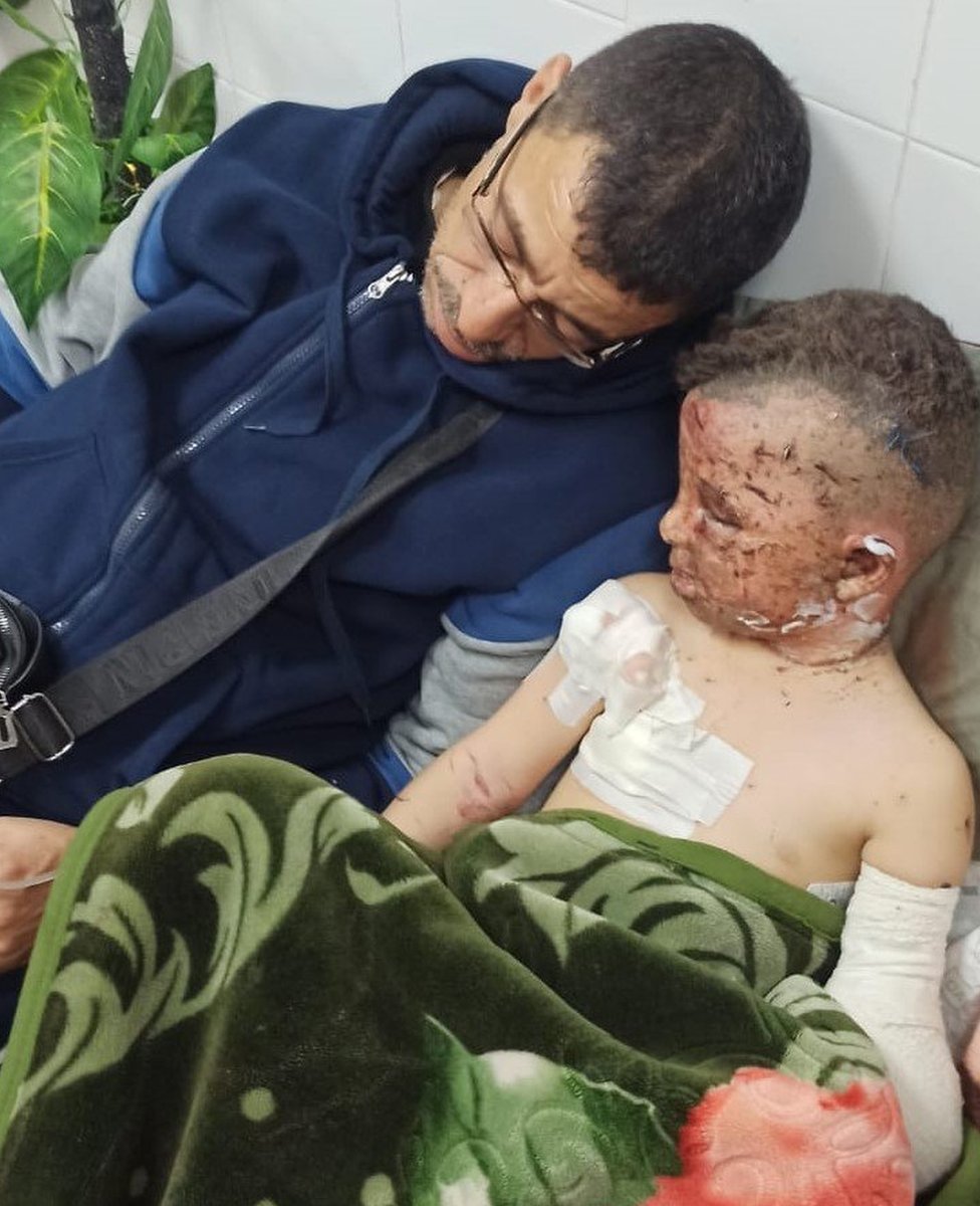Omar (right) with his uncle Moein Abu Rezk at Al-Aqsa Martyrs Hospital in Deir al-Balah, in the central Gaza Strip