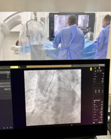 DR ILISIĆ Baloni sa lekom u lečenju krvnih sudova srca bez ugradnje stranog materijala 3