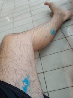 "Prljavi smo, a koža nam smrdi": U SC "Čair" radi sveže ofarban bazen, a kupačima koji su se ofarbali bojom dat je razređivač "da se očiste" 7