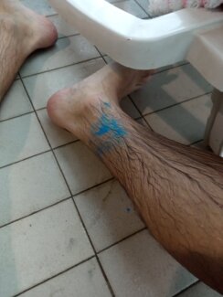 "Prljavi smo, a koža nam smrdi": U SC "Čair" radi sveže ofarban bazen, a kupačima koji su se ofarbali bojom dat je razređivač "da se očiste" 6