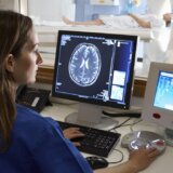 Znaci koji nas upozoravaju da naš mozak brzo stari, a na koje treba posebno da obratimo pažnju 1