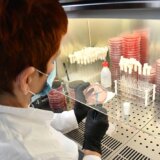 Jednostavan test pljuvačke obećava mnogo u borbi protiv raka prostate 9