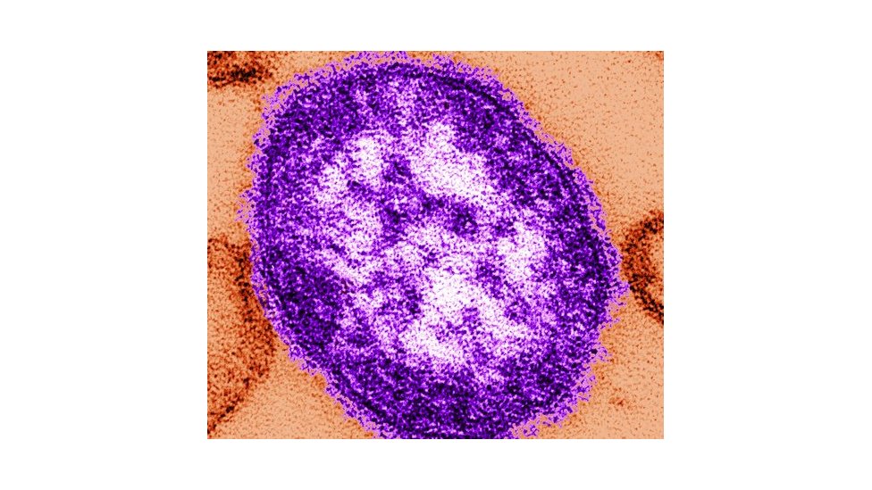 The measles virus as seen from a microscope