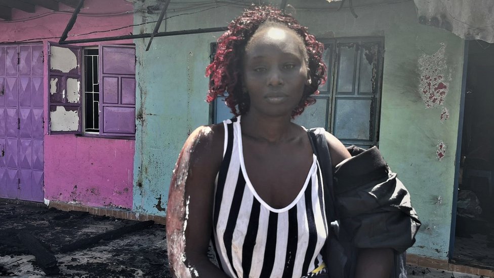 Požar u Najrobiju: Troje poginulo, a skoro 300 povređeno u eksploziji gasa u Keniji 1 Žena sa opekotinama na ruci