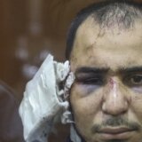 Moskva: Mučenje koje svi treba da vide 12