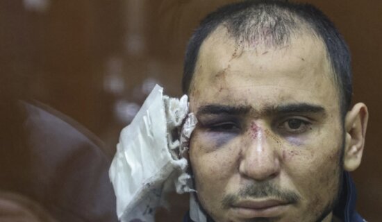 Moskva: Mučenje koje svi treba da vide 11