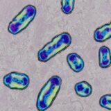 Zdravlje: Kako je bubonska kuga promenila ljudski imuni sistem 2